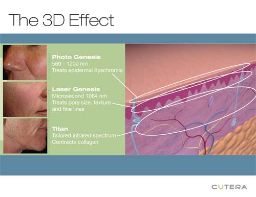 3D Skin Rejuvenation